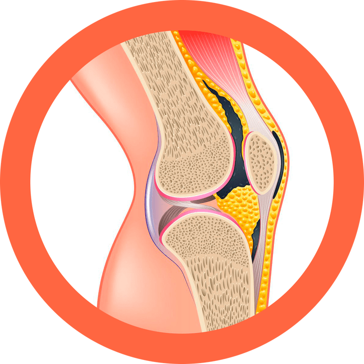Hondroten - restaura articulações e músculos