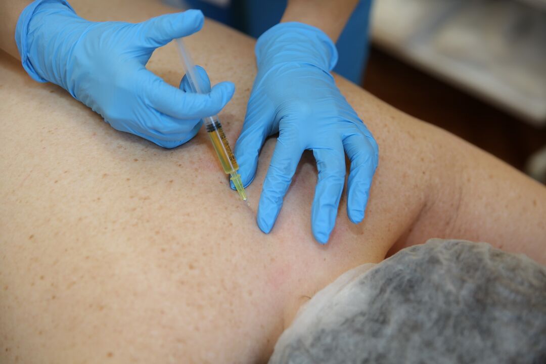 injeções de condroprotetores para as costas